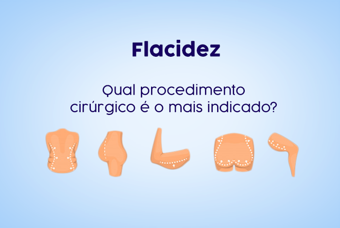 Flacidez: Qual procedimento cirúrgico é o mais indicado?